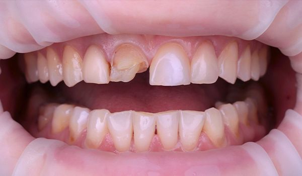 фото ДО